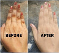 Knuckle Removal Kit – Before and After