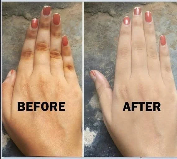 Knuckle Removal Kit – Before and After