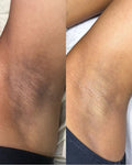 Hyper Pigmentation Clearing Soap